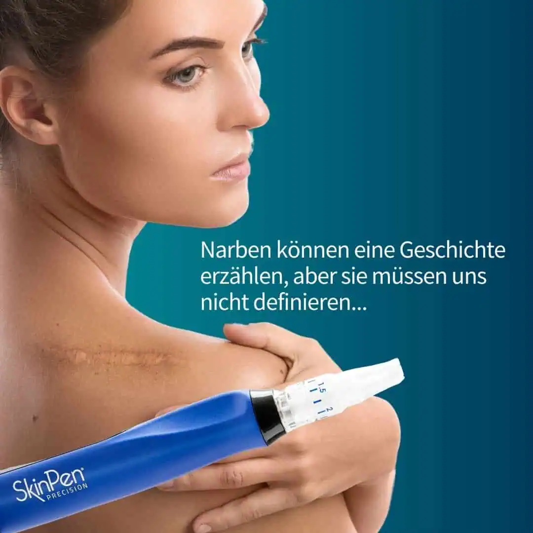 SkinPen Microneedling Gerät