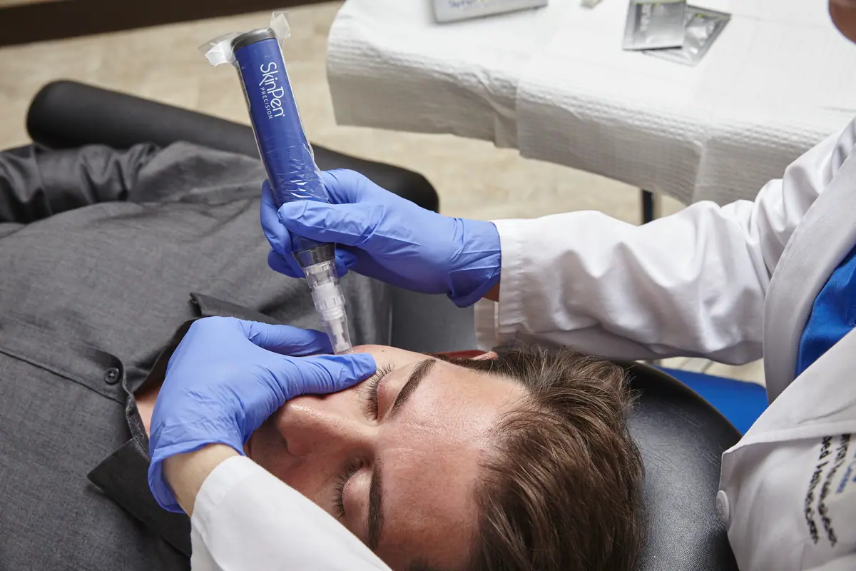 Microneedling mit SkinPen bei DermaDay